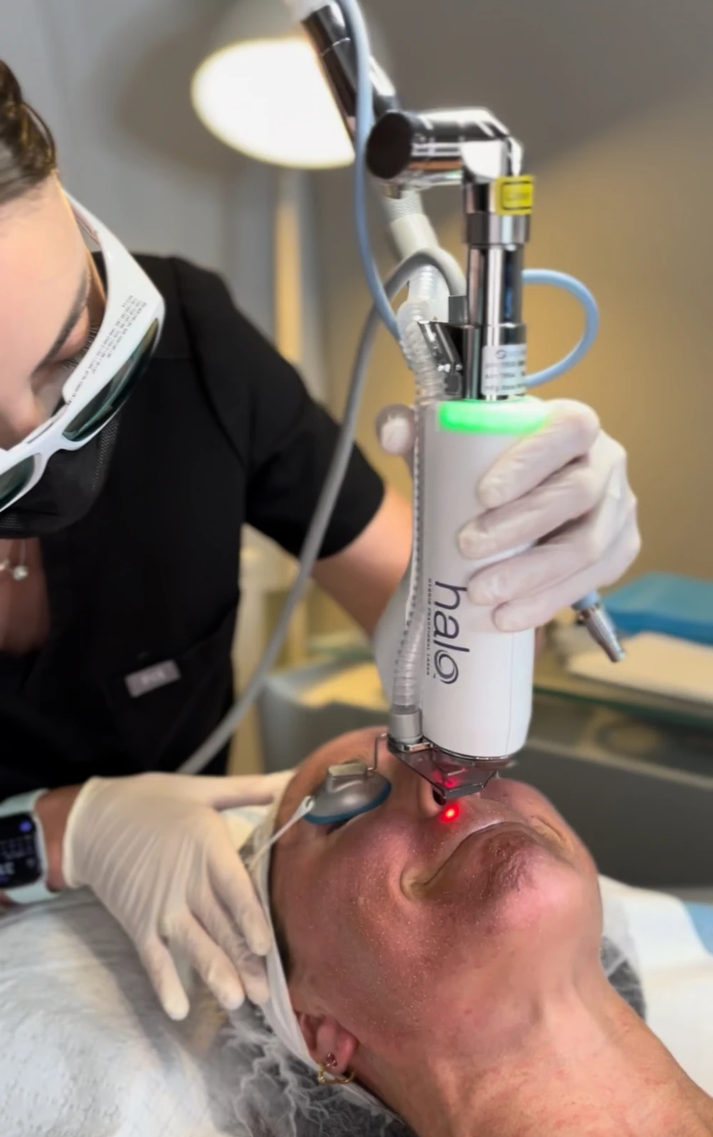 skin laser